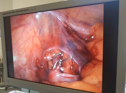 Попередження про вразливий контент